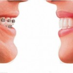 ClinicaAngeles: Ortodoncia
